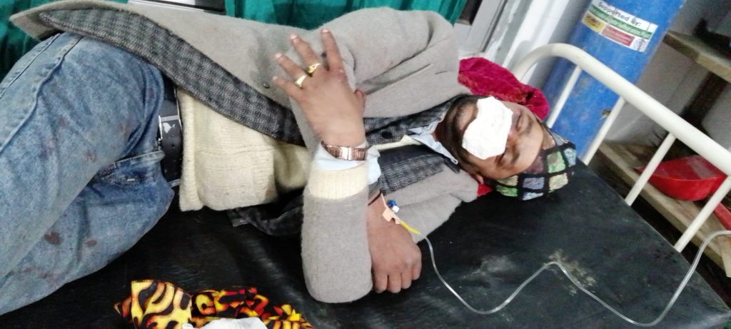 डेउडा गायक जोशीमाथि कुटपिट