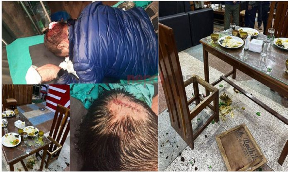 गोरखा २ मा अब्दुस मियाँको प्रचारप्रसार टोलीमाथि आक्रमण